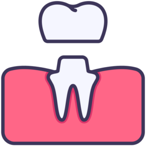 Dental filling or Crown