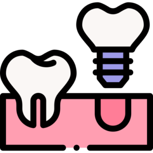 dental-implant