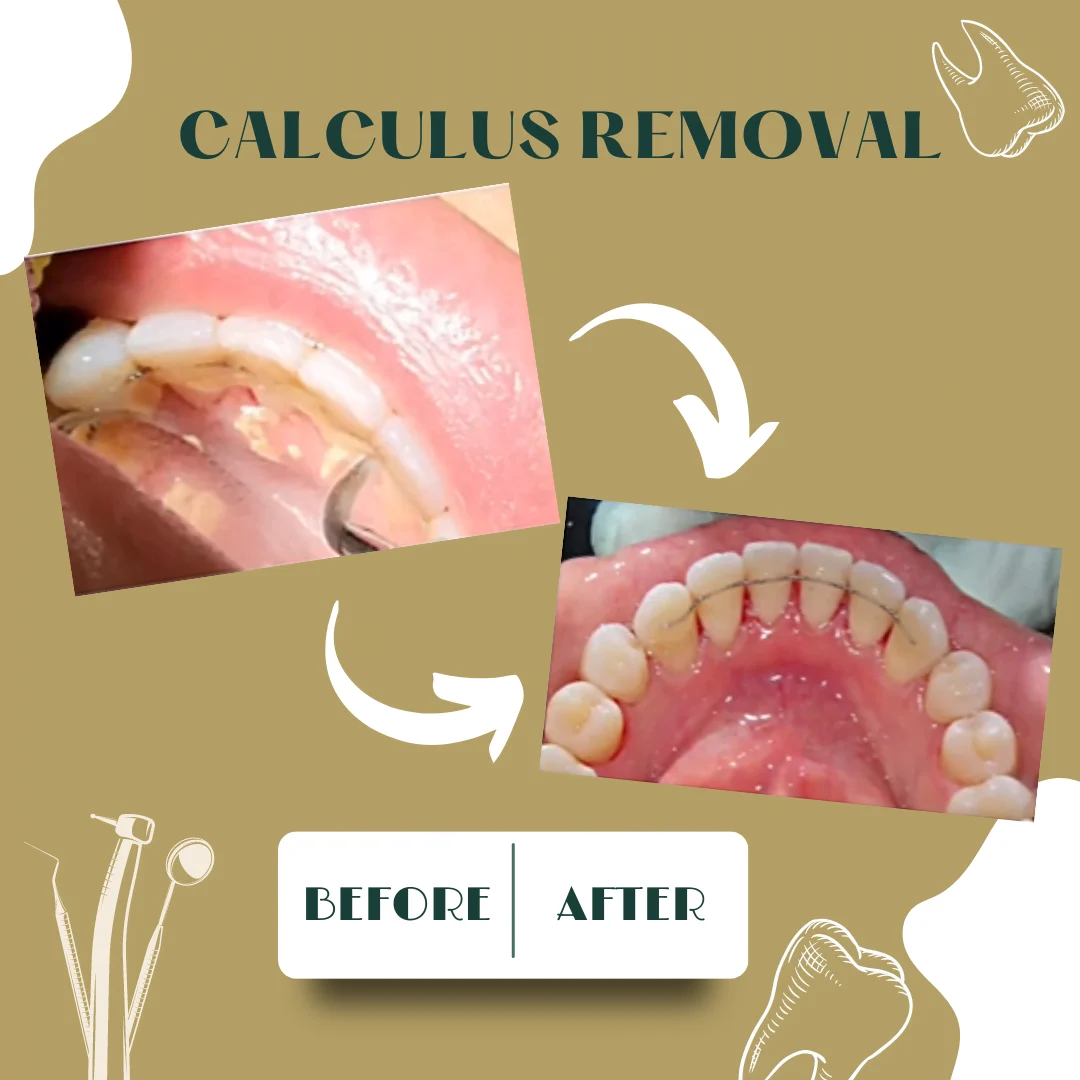 Caso dental, antes y después 1