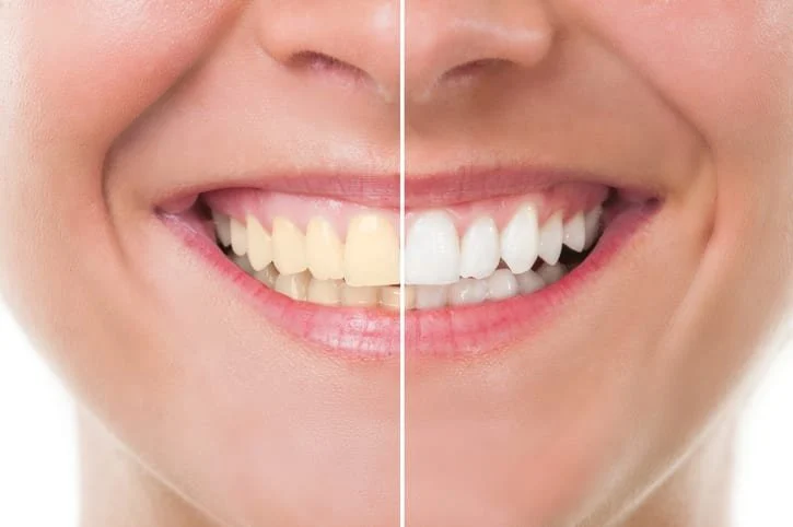Odontología estética