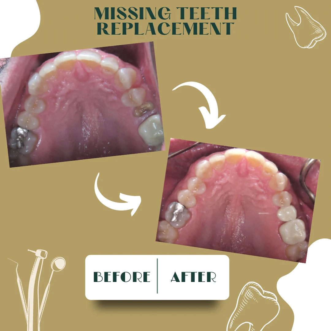 Caso dental, antes y después 25