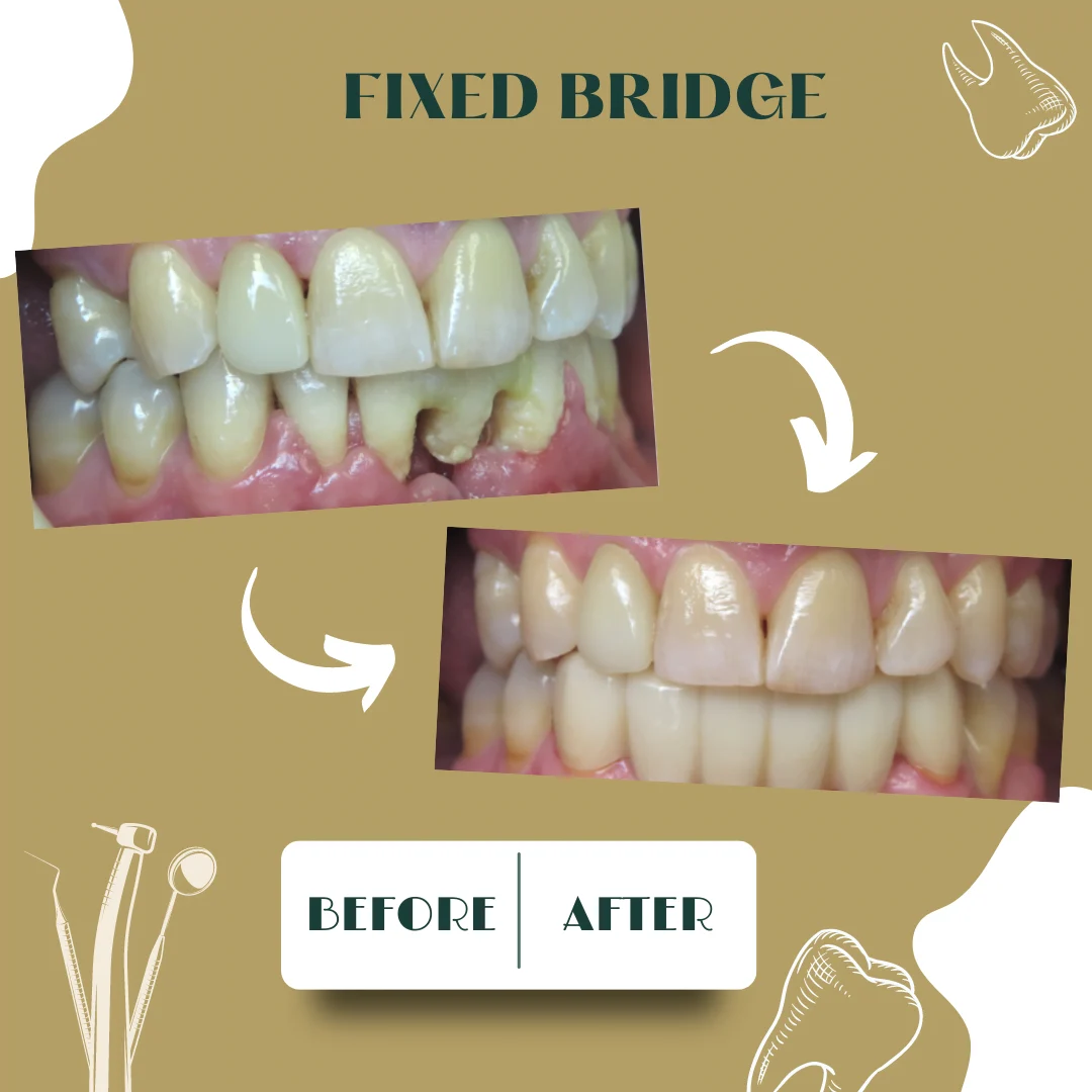 Caso dental, antes y después 24