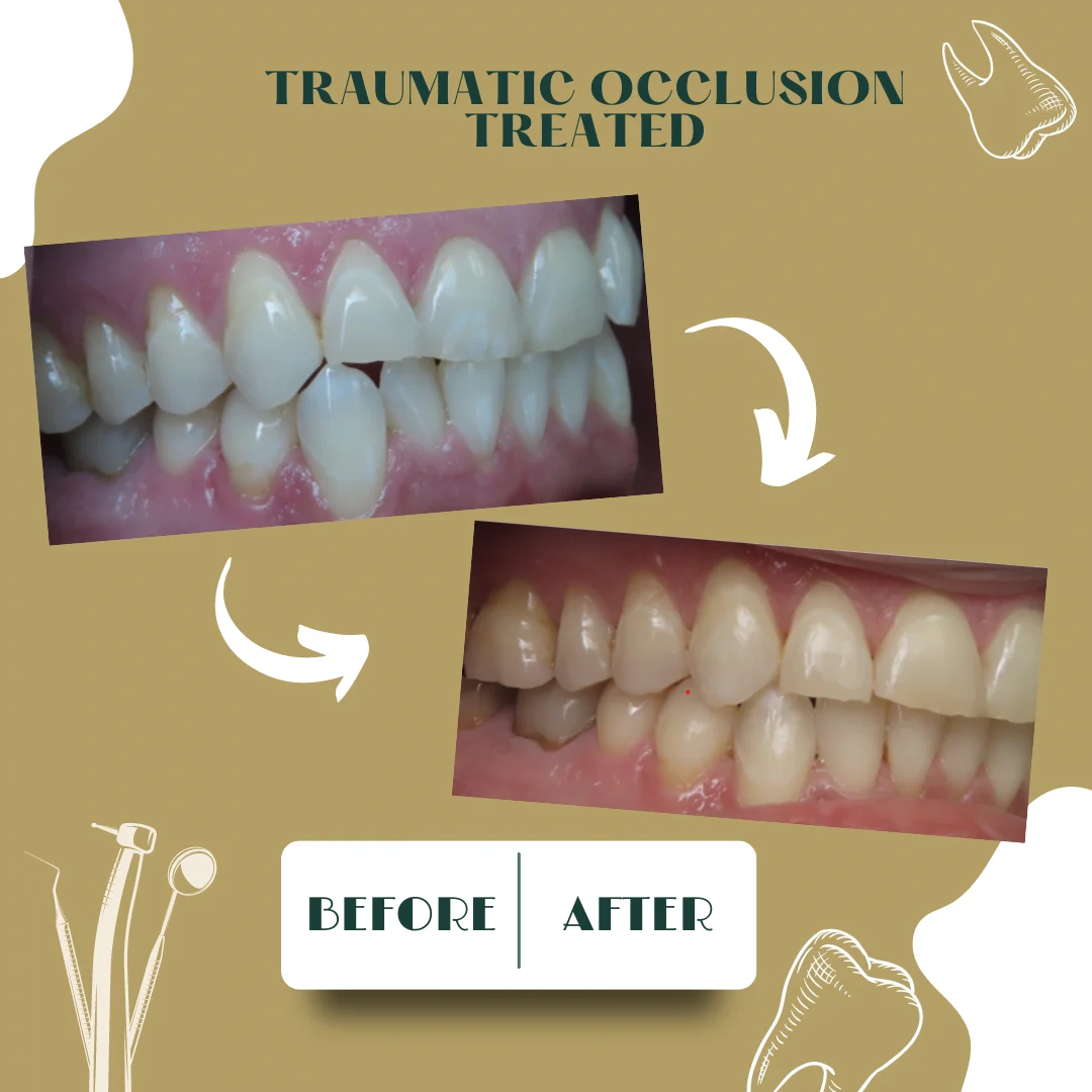 Caso dental, antes y después 21