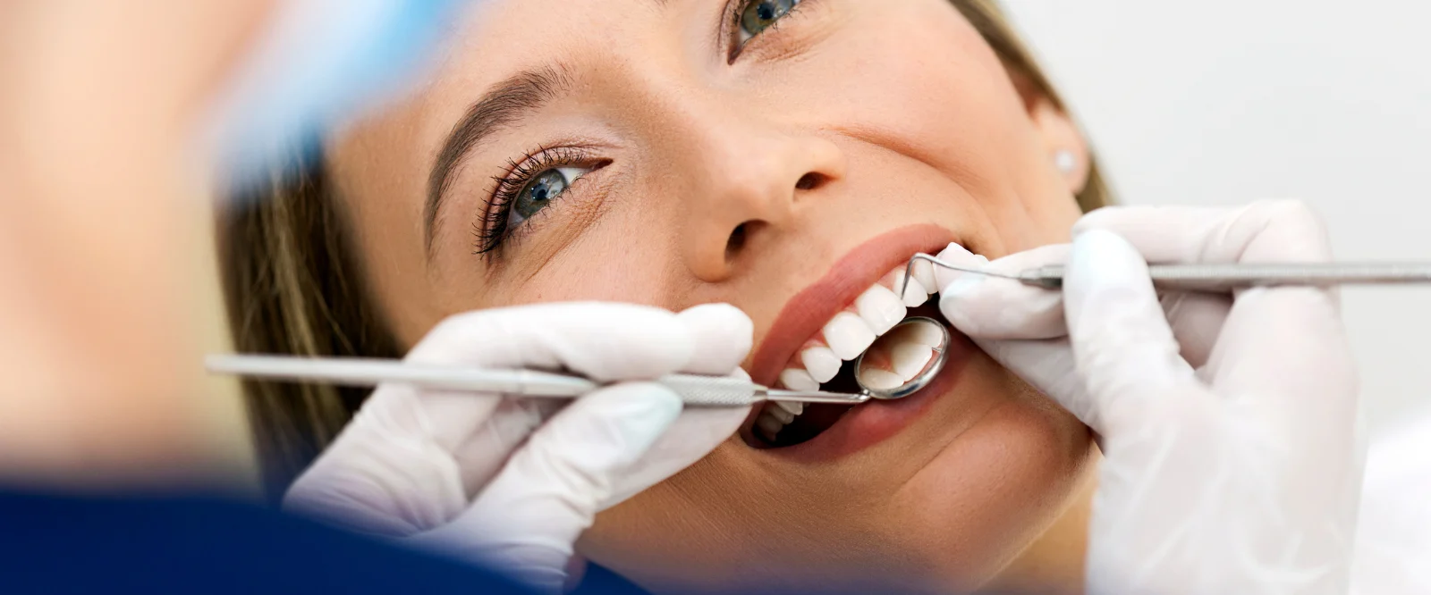 Imagen ilustrativa de atención y servicios dentales