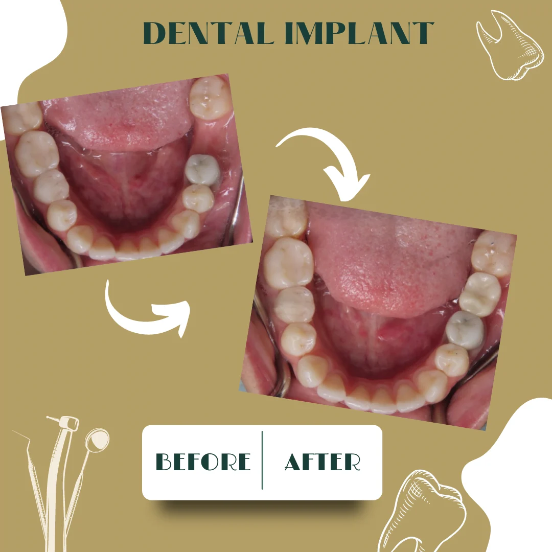 Caso dental, antes y después 29