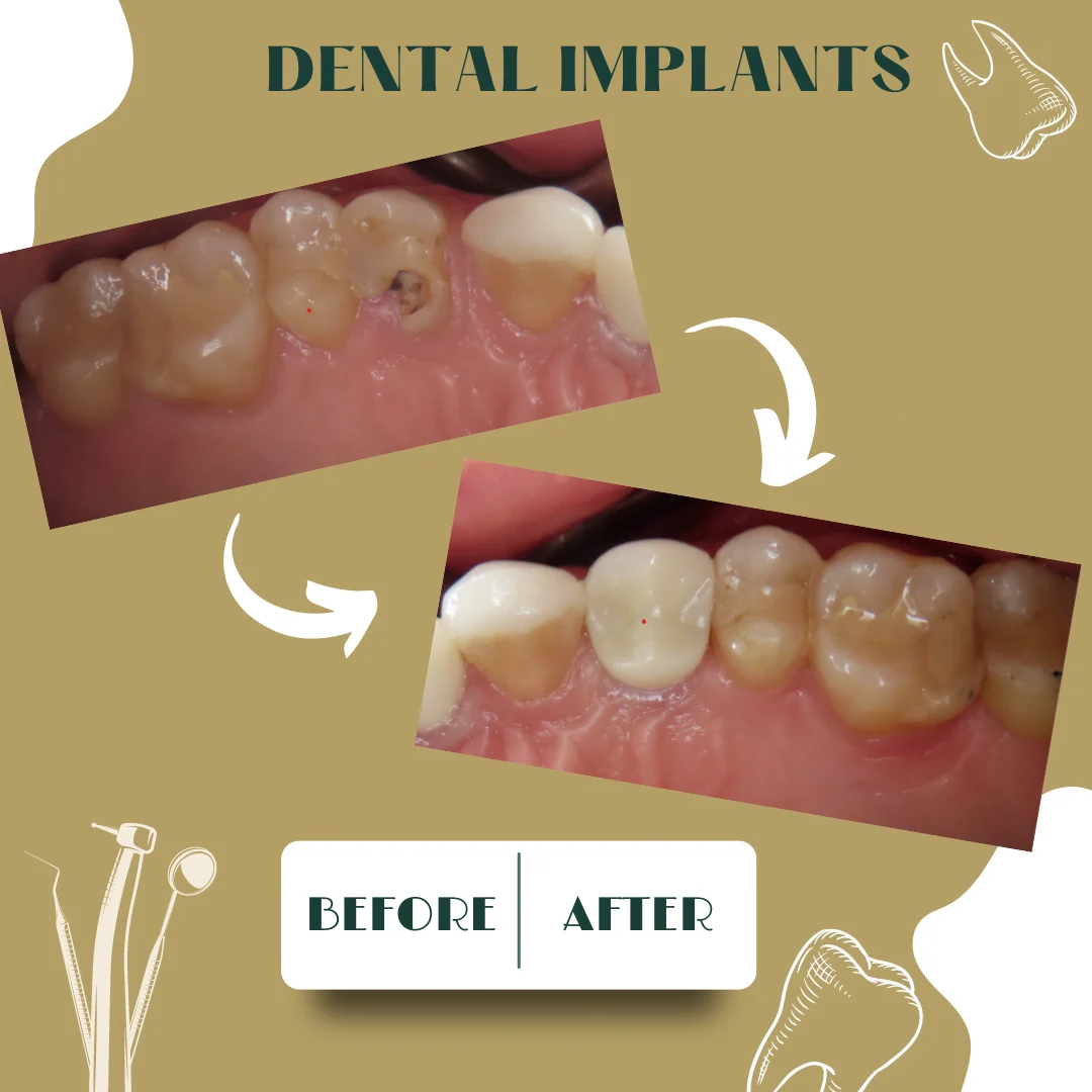 Caso dental, antes y después 19