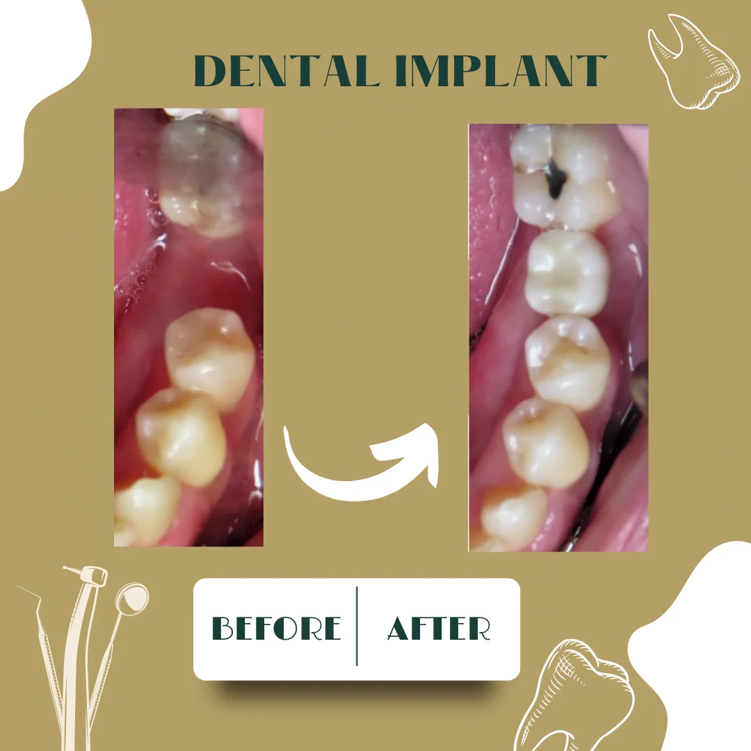 Caso dental, antes y después 23