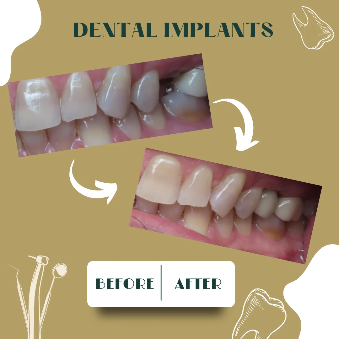 Caso dental, antes y después 20