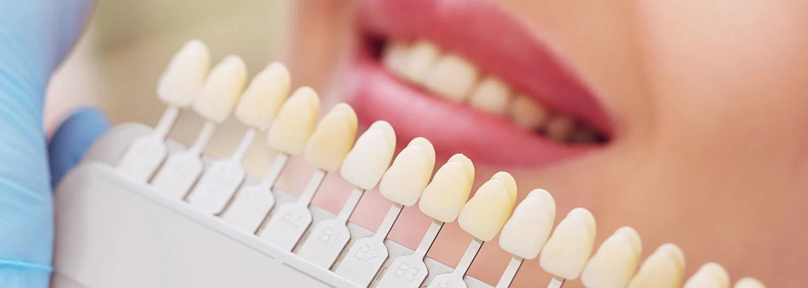Imagen ilustrativa de atención y servicios dentales