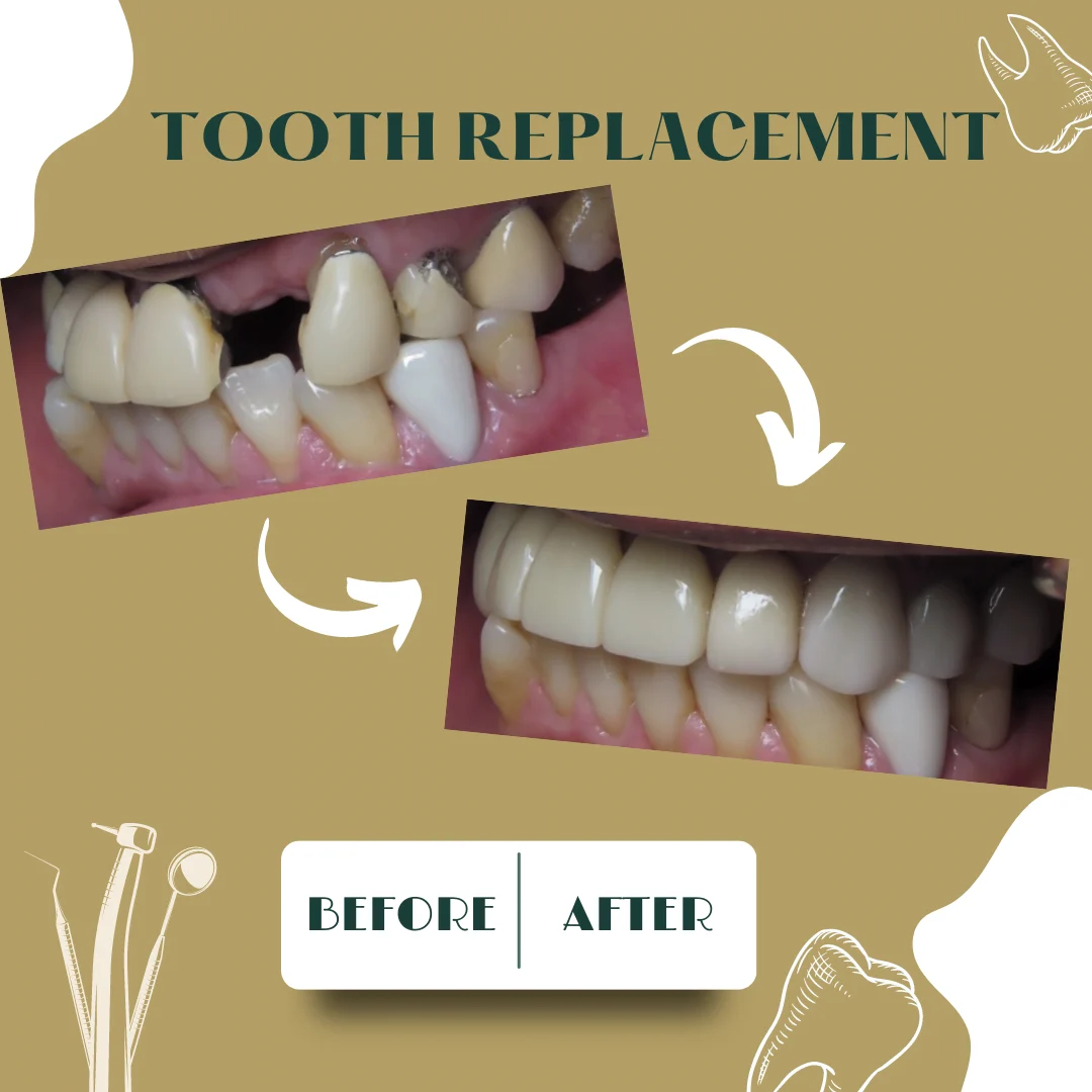 Caso dental, antes y después 9