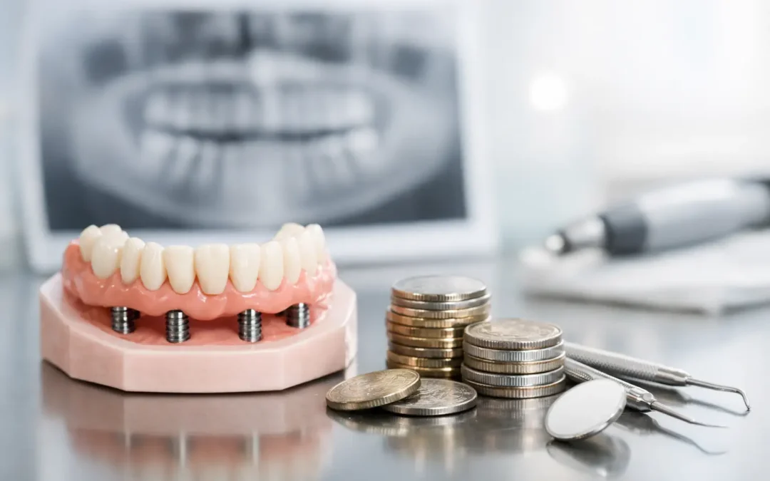 Full Arch Restoration Cost Explained